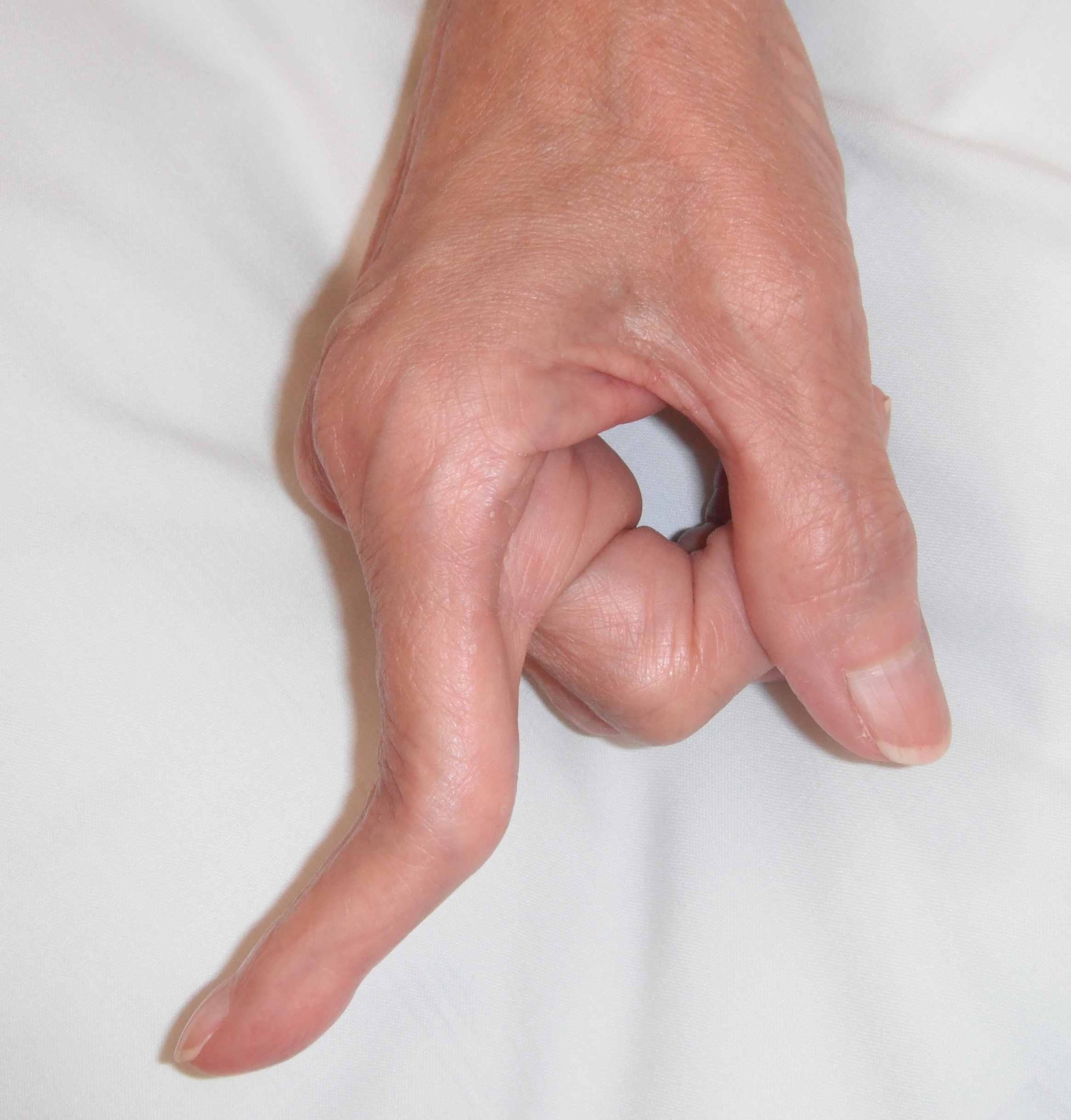 Swan Neck Finger 1